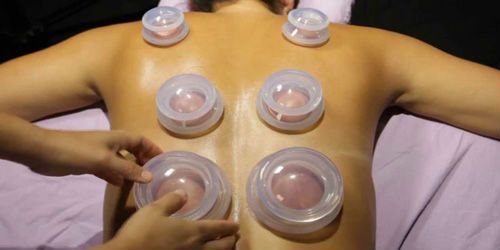 Cupping Services Image